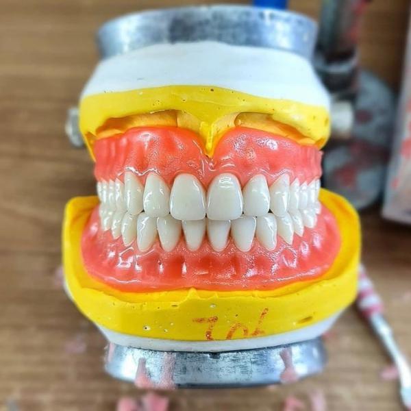 آگهی ساخت انواع دندان مصنوعی